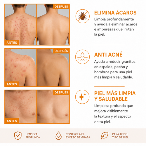 Gel Corporal Anti Acné