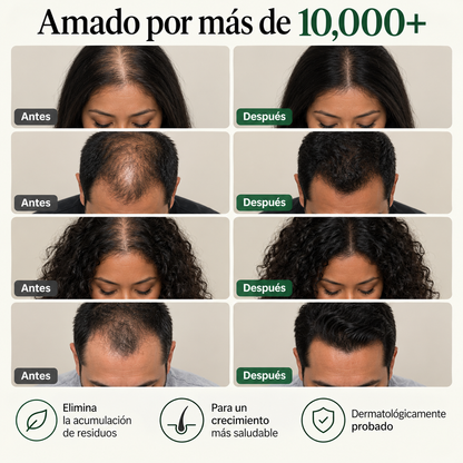Bleiro™ Shampoo Sólido Coreano